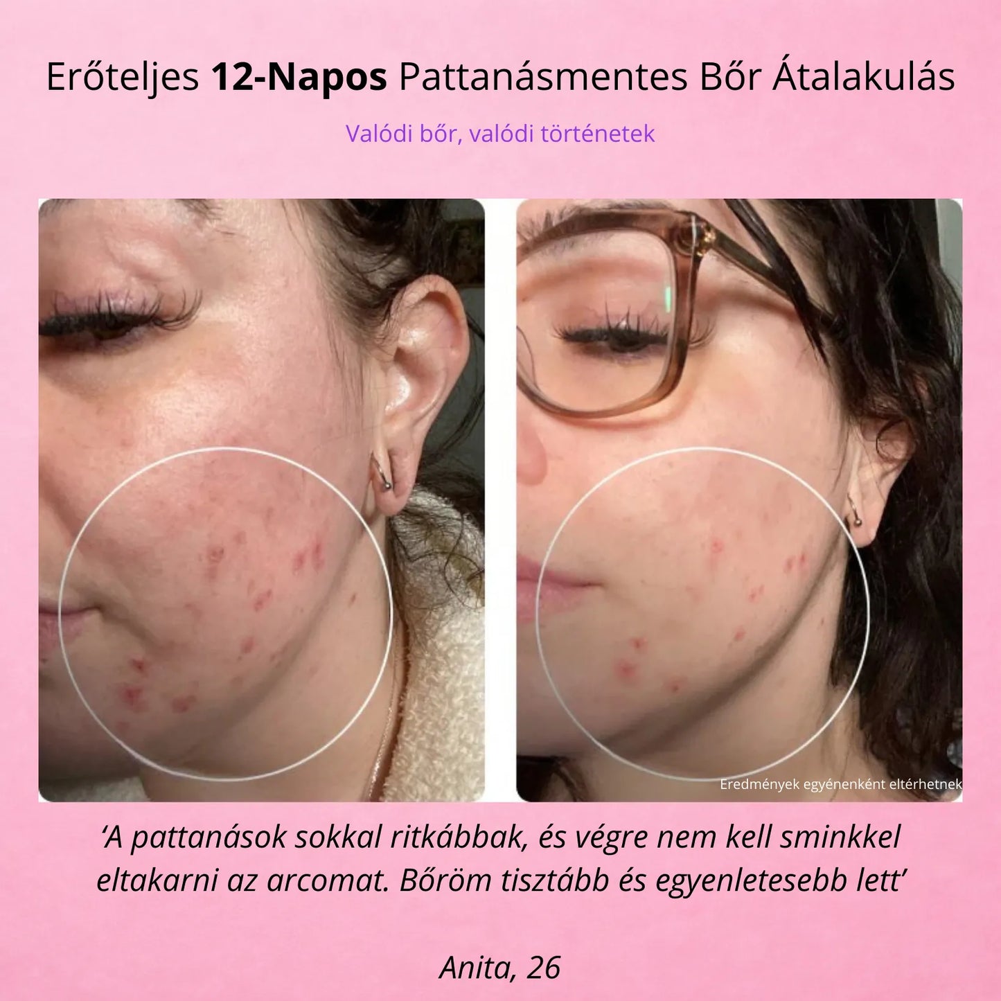 GloryDayy Magas Frekvenciás Pálca