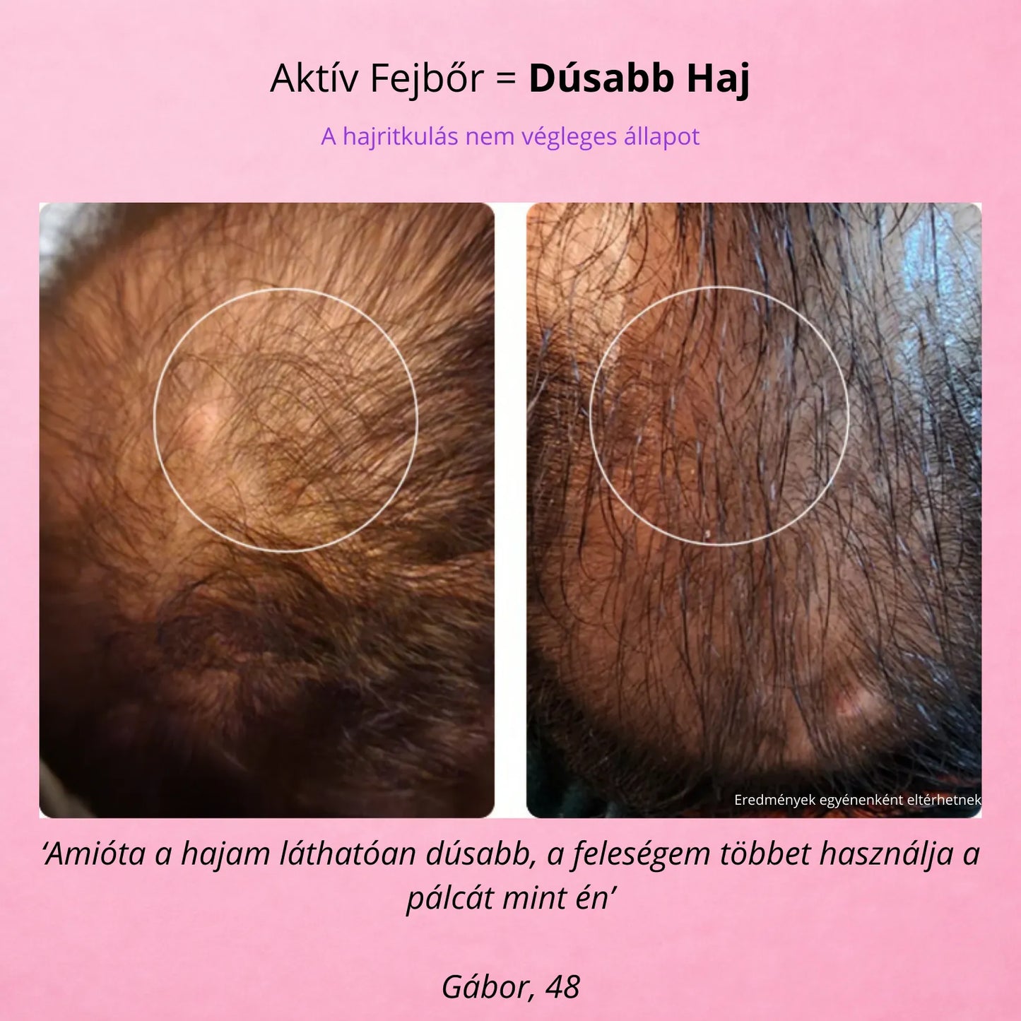 GloryDayy Magas Frekvenciás Pálca