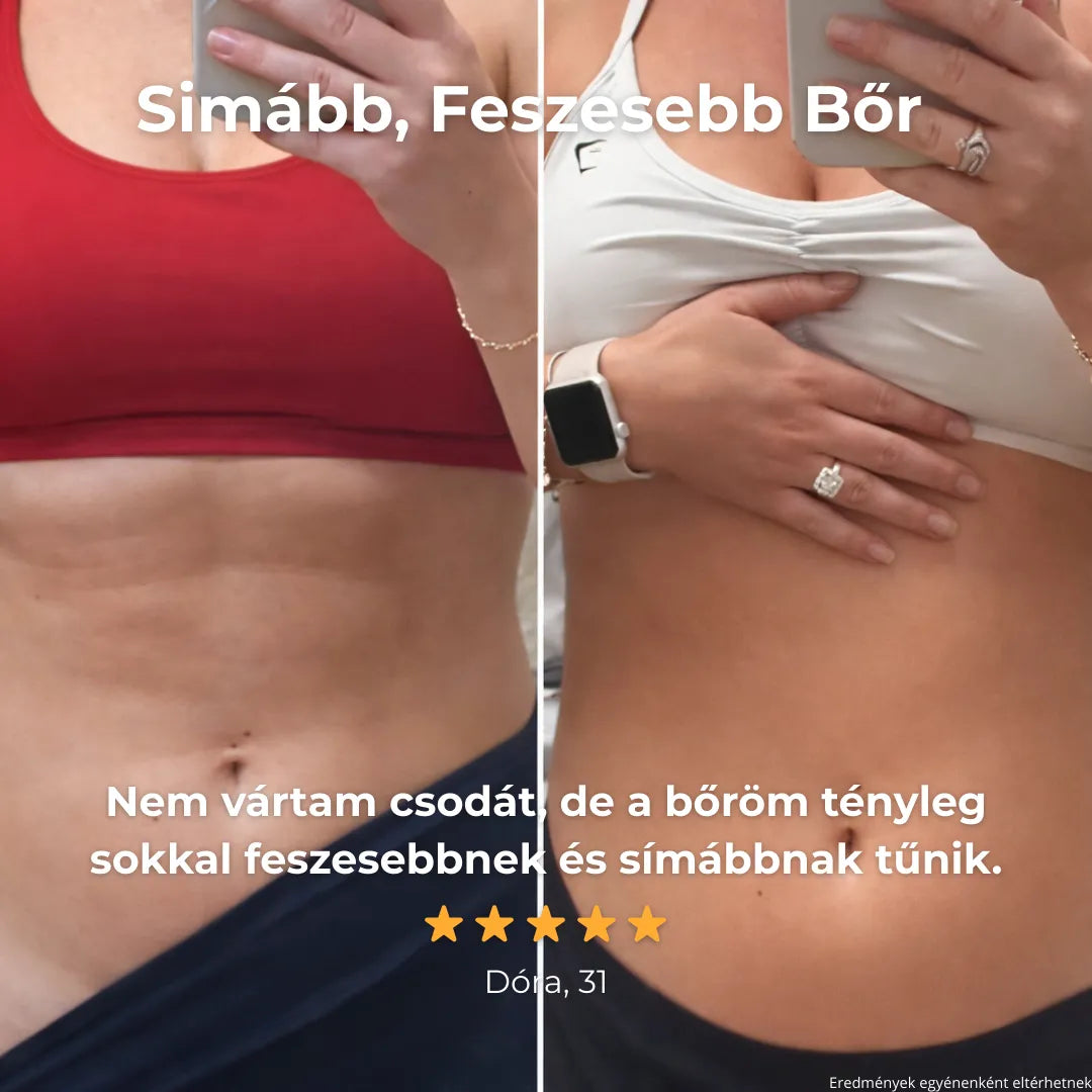 Glorydayy™ Vákuum Feszesítő