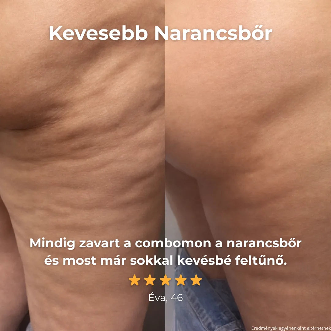 Glorydayy™ Vákuum Feszesítő