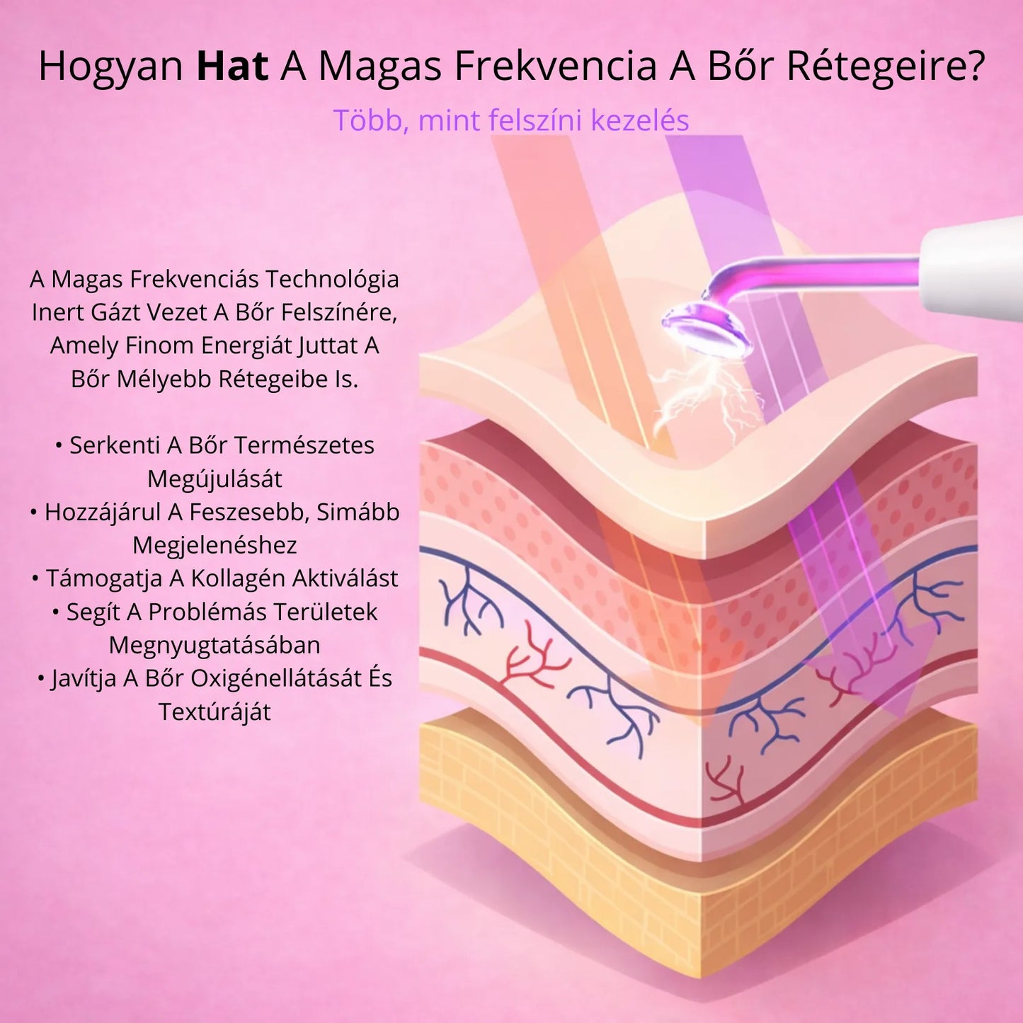 GloryDayy Magas Frekvenciás Pálca