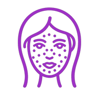 Támogatja a kollagéntermelést